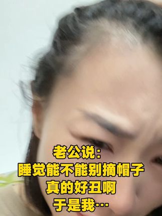 那怎么了!这就让你看看!#司缪小黑丸 #smeal #逆袭 #补铁丸 #生物素