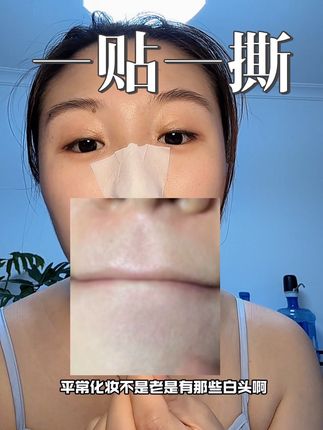 用了十几年了,便宜又好用#强烈推荐 #平价好物 #黑头白头 #去黑头小妙招 #泰国黑头水
