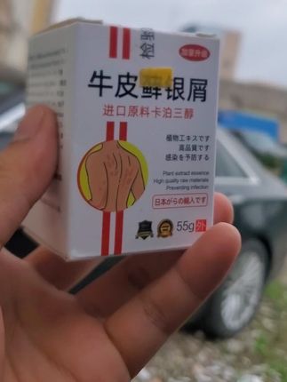 #头皮痒怎么办 #头发屑 #卡泊三醇倍他米松软膏 #牛皮膏 #银屑牛皮