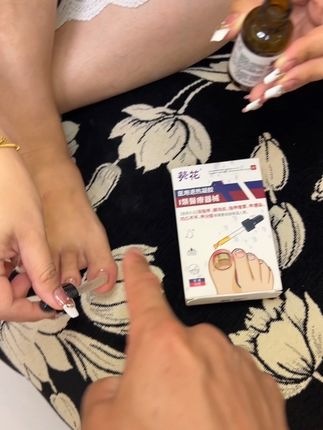 葵花官方正品医用#灰指甲