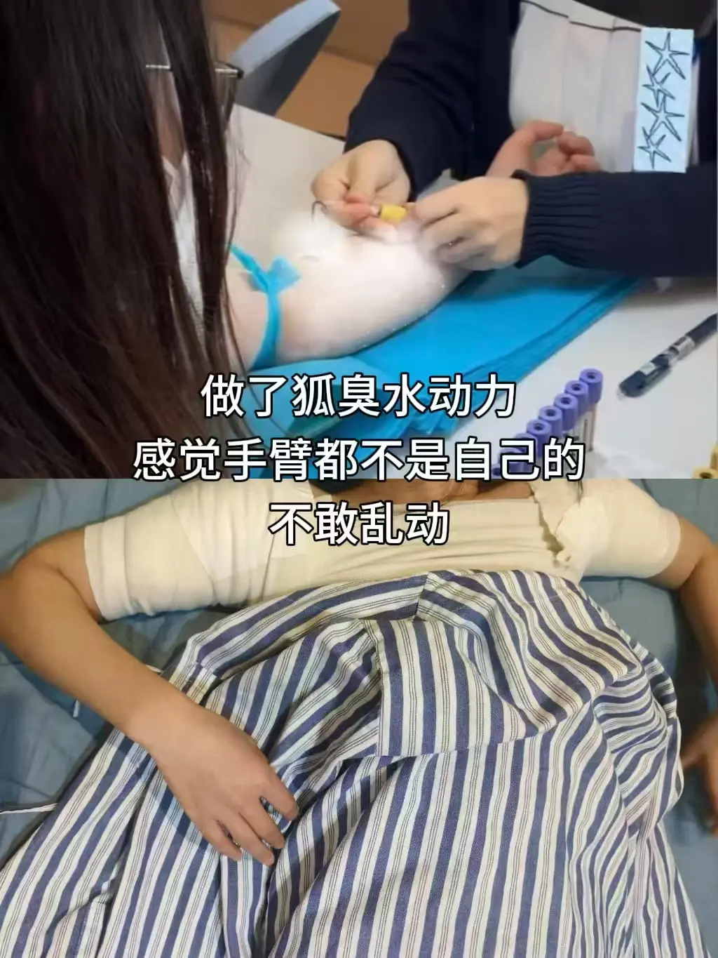 刚做完狐臭水动力😭 现在俩胳膊跟灌了铅一样,又胀又酸,感 - 抖音