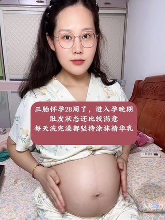 #孕期好物分享 每天坚持涂抹身体精华乳#三胎 孕妈经验涂油一定要趁早#袋鼠妈妈妊娠油 #孕期护肤#准妈妈孕妈妈