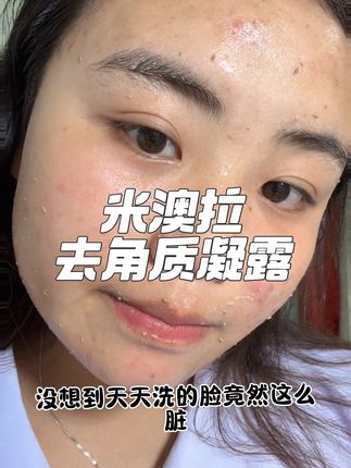 没想到它竟然是底妆服帖的秘籍! #日常护肤 #好皮肤养出来 #好物推荐🔥 #护肤分享 #米澳拉去角质凝露