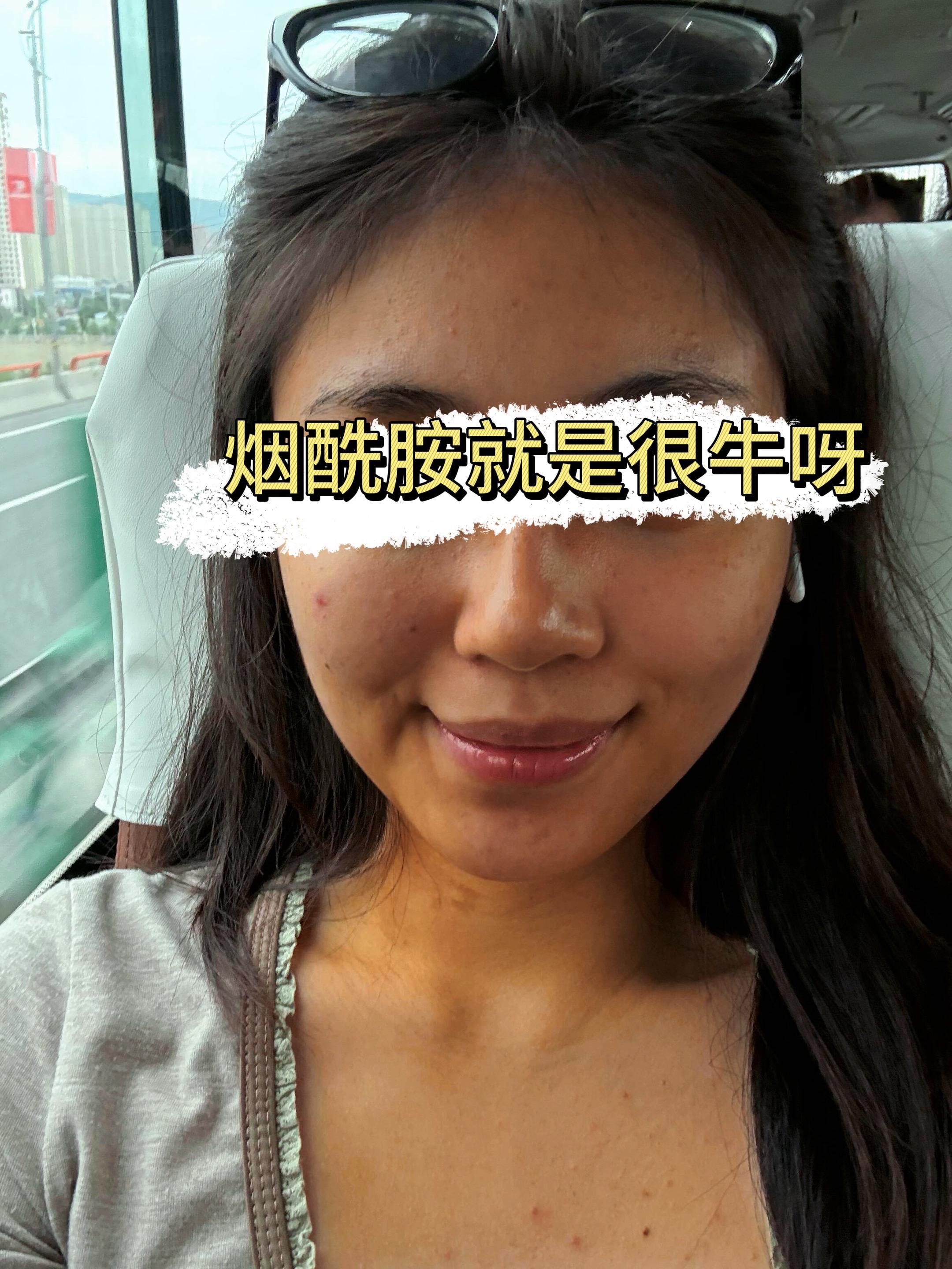 现在开始让身边的人对你刮目相看#烟酰胺#变美小技巧#男女通用 #提升自己 #亲测分享