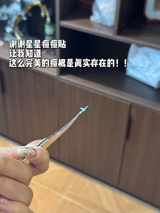 谢谢星星痘痘贴!一定认准正版哦!#痘痘 #痘根