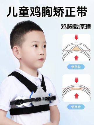 儿童鸡胸矫正器#儿童鸡胸矫正带#幼儿畸形胸骨护具夹板#胸骨矫正器#收肋骨外翻矫正带#儿童鸡胸固定护具