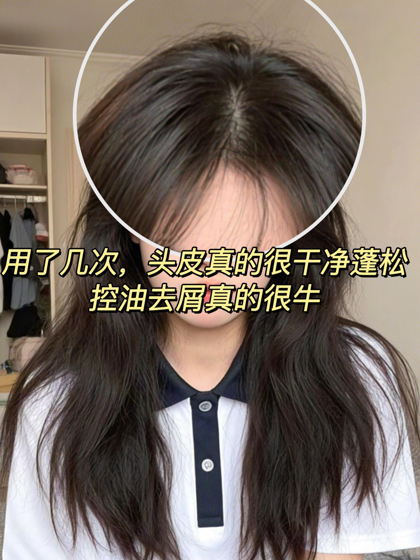 不想天天洗头的看过来!这个袋鼠妈妈青少年洗发水真的太好用了,洗一次可以捧好几天,依然是放心用的无硅油配方,搭配了天然植萃特百叶、漫金果和桑根皮,全都是对头皮好的东西。还有蓬松黑科技离子护士技术,洗完的头发蓬松顺滑不油腻,关键大人孩子都可以一起用。#洗发水推荐 #袋鼠妈妈青少年洗发水#油屑头 #学生党 #控油去屑