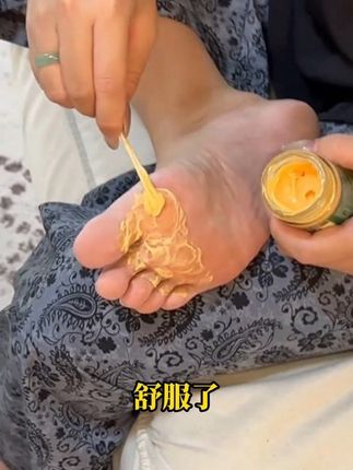 天气热了,想穿拖鞋凉鞋的,抓紧用起来!#老国货 #真菌王 #国货之光 #亲测分享