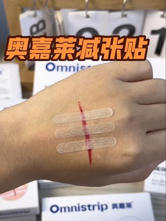 伤口拆卸后就可以使用减张贴了。推荐这款奥嘉莱医用免缝胶带,符合医用标准,使用更放心。它可以通过物理拉力让伤口紧贴愈合,有效减轻伤口扩张和增生,伤口愈合前3个月尤为重要#医用减张贴#奥嘉莱减张贴 伤口减张贴