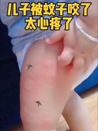 紫草膏现在准备,蚊虫叮咬全家都能用,出门放包里也方便,等蚊子出来再买就来不及了#母婴好物 自用好物分享 #大人小孩都可以用