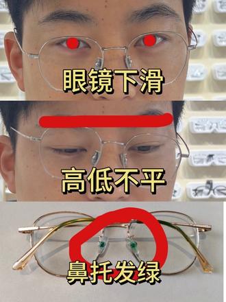 眼镜戴两三个月以后很容易出现变形,有的顾客觉得来眼镜店比较麻烦。今天给大家分享一下眼镜的简单调整和维修。#专业验光配镜 #眼镜维修 #鼻托更换
