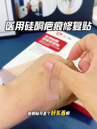 疤痕贴不要买错了,认准老牌子械字号准没错 #疤痕贴#家庭必备#好物推荐🔥 #超便宜超划算 #好东西一起分享