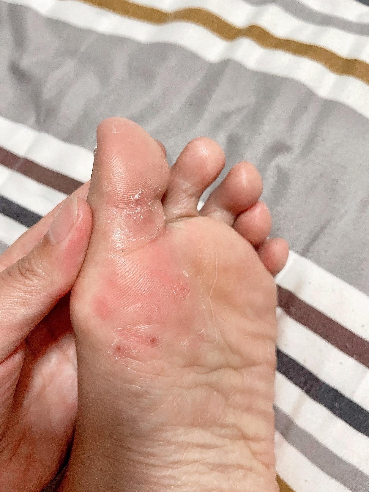 哎吆!我的小脚脚🦶🏻🦶🏻#脚 #脚丫子 #脚宽脚胖都可以 #生活 #
