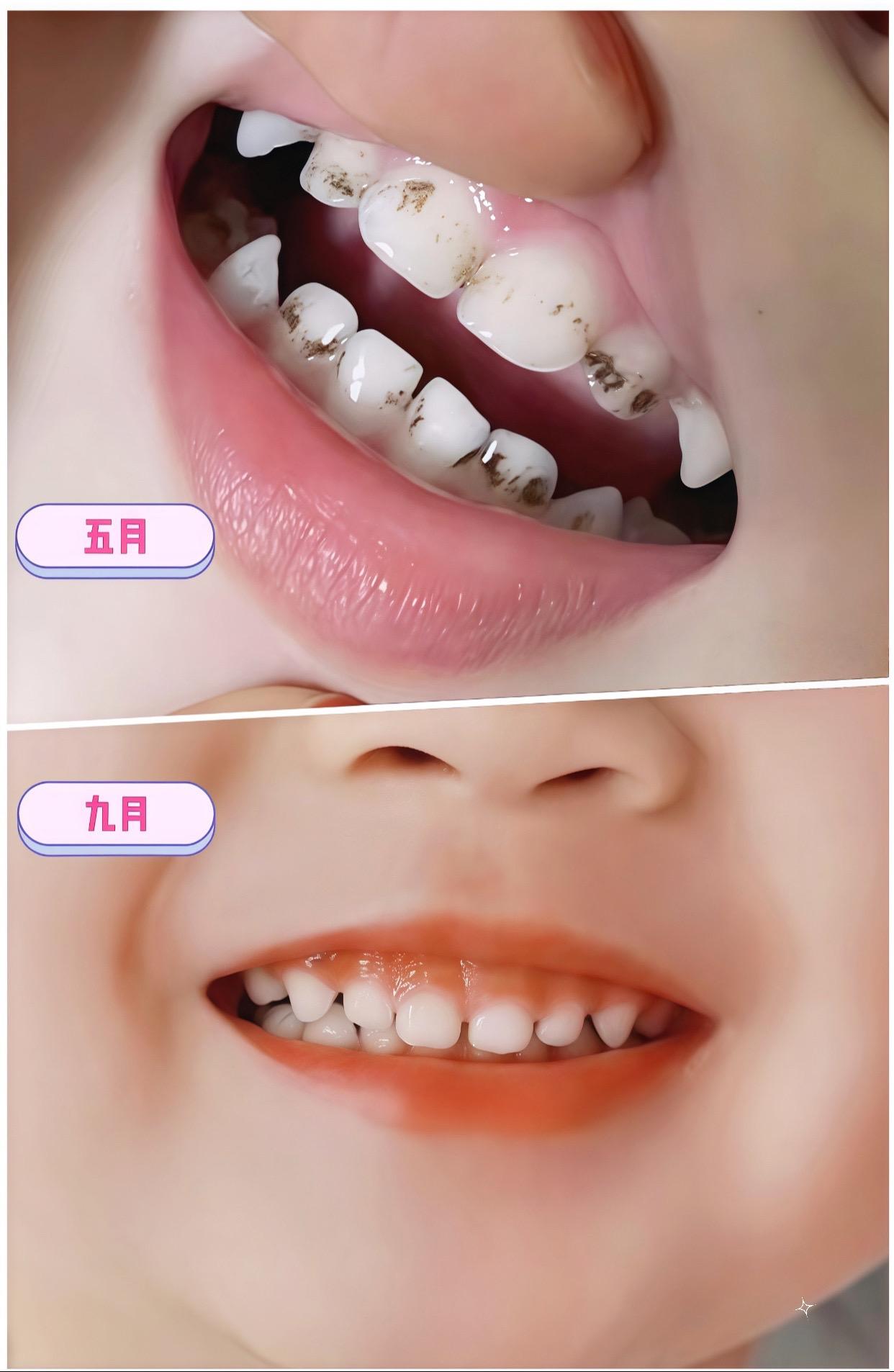 #舒客 #舒客宝贝儿童牙膏 #抗糖防蛀 #儿童牙膏#爱牙护牙