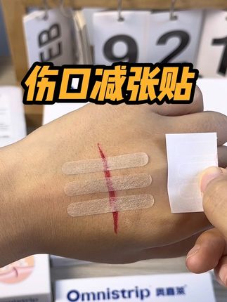 黑怕疤痕变大变丑的朋友,你就选这款奥嘉莱减张贴,真的有效果#医用减张贴 #奥嘉莱减张贴 #伤口减张贴