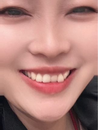 呵呵