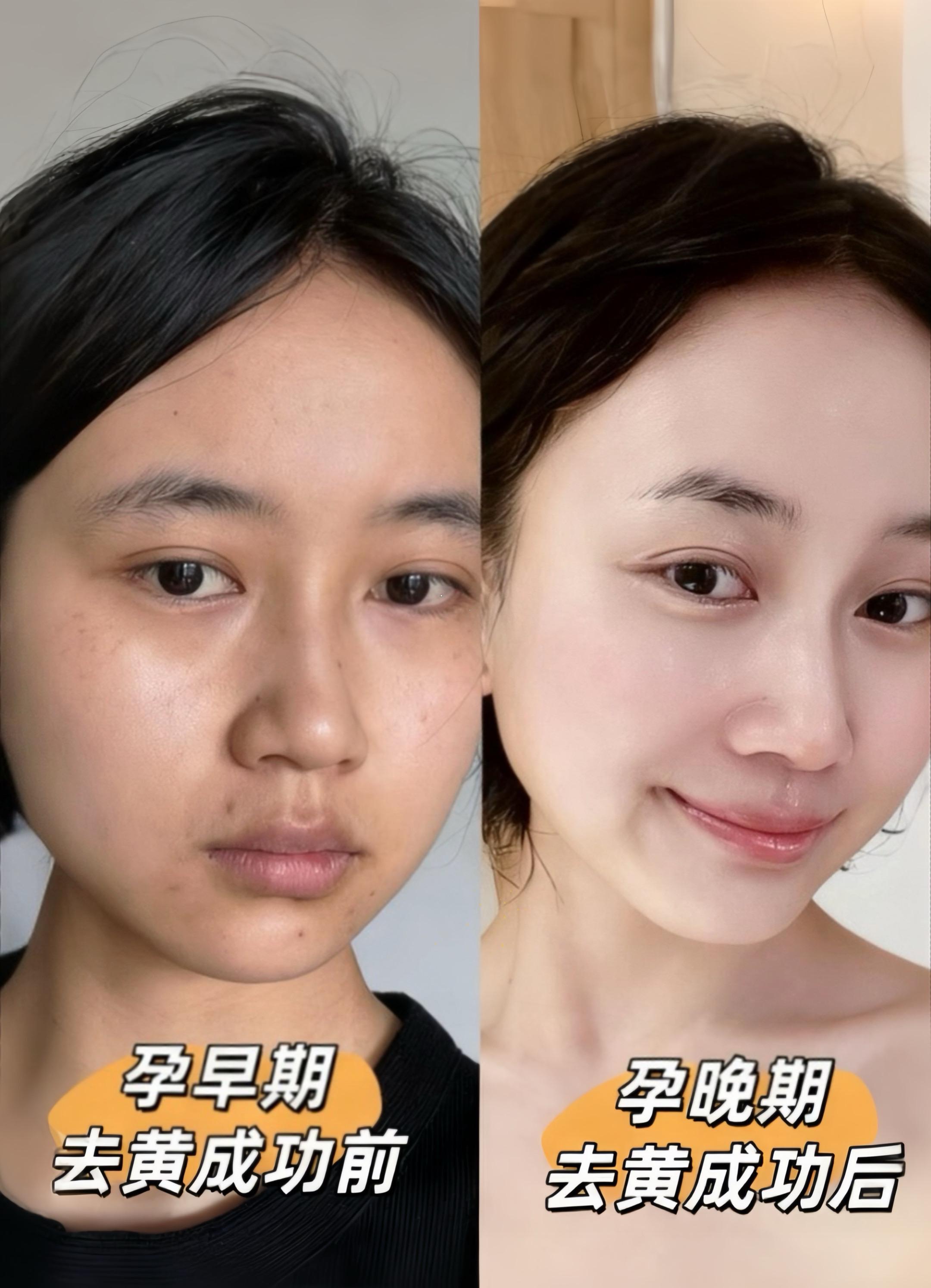 孕期可以不化妆,但要坚持敷面膜呀~#变美逆袭 #强烈推荐 #每日护肤 #孕期护肤 #袋鼠妈妈 @抖加🔥上热门🔥dou+🔥热点宝 @DOU+上热门
