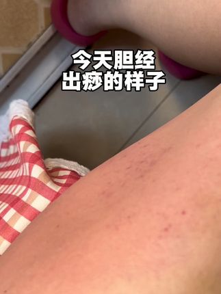 #拍痧#经络疏通#拍痧板#大健康