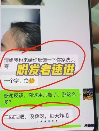 睁开眼的幸福就来源于大家的支持与信任,好评反馈越来越多,大家买回去心态放好,就当普通洗头膏去使用,只要坚持,必🈶️收获,希望“它”能帮所有脱发严重者带来福音,再次感谢大家的支持与信任🥰🥰🥰