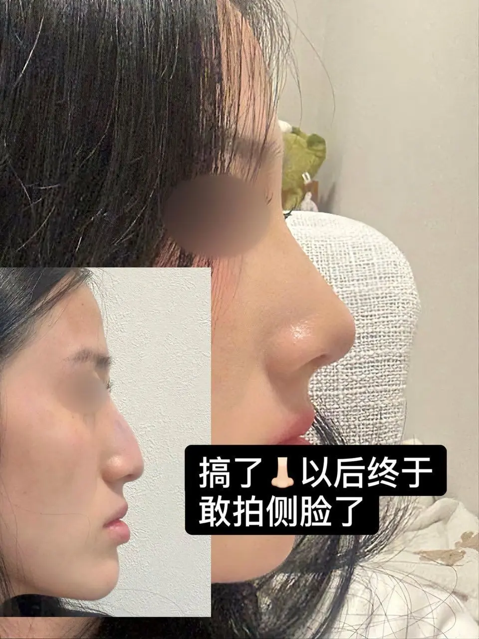 这下我将成为侧脸战士 #上海高振强 #侧脸 #东方七度美鼻 - 抖音