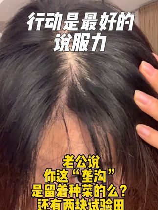 永远不要沉浸在情绪当中,用行动力直接去实践,是人生最好的觉醒。#补铁 #补铁软糖 #生物素