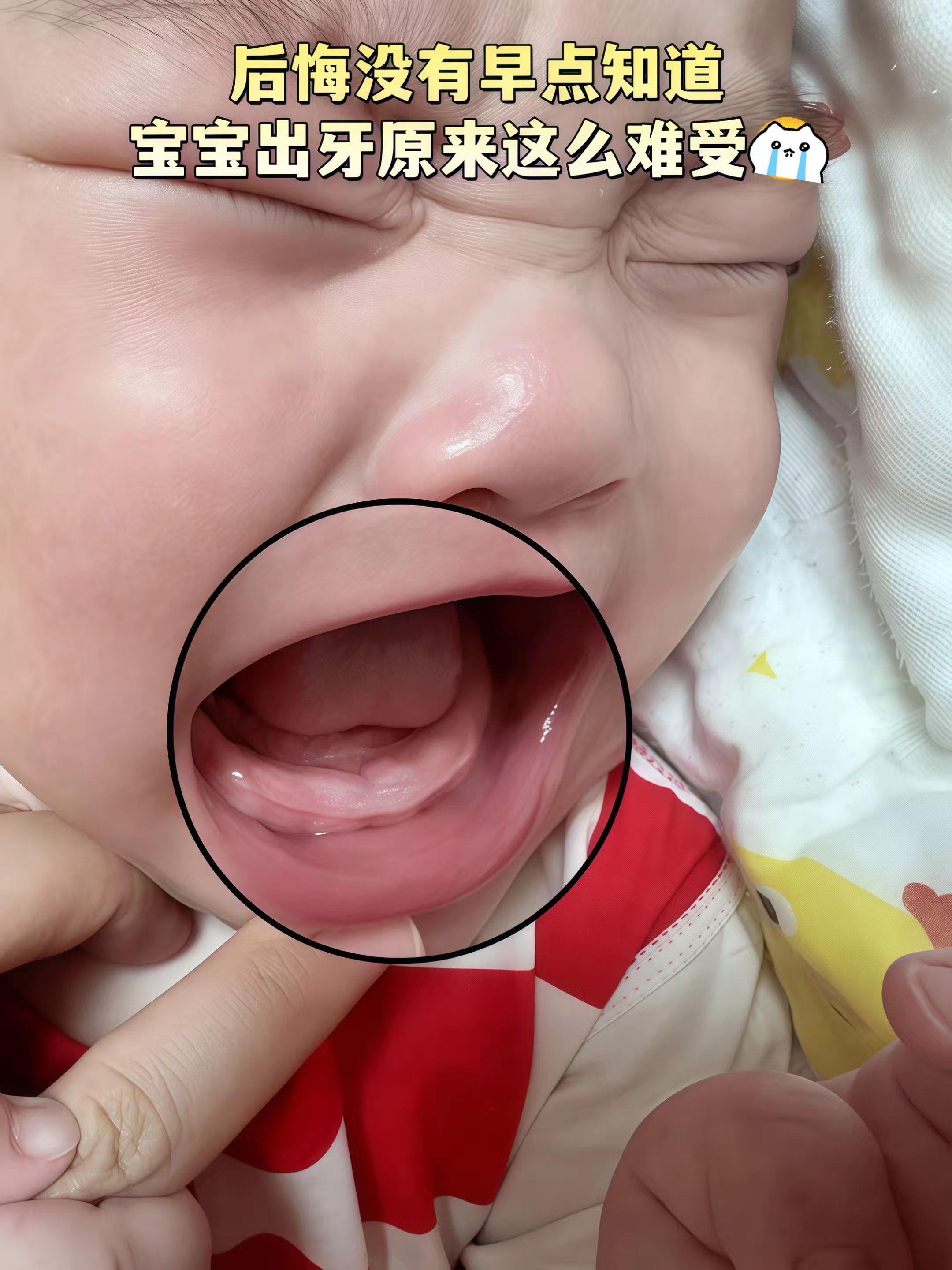 #长牙期的宝宝 #出牙期 #出牙痛 #磨牙棒 #宝宝爱吃 @抖加🔥上热门🔥dou+🔥热点宝