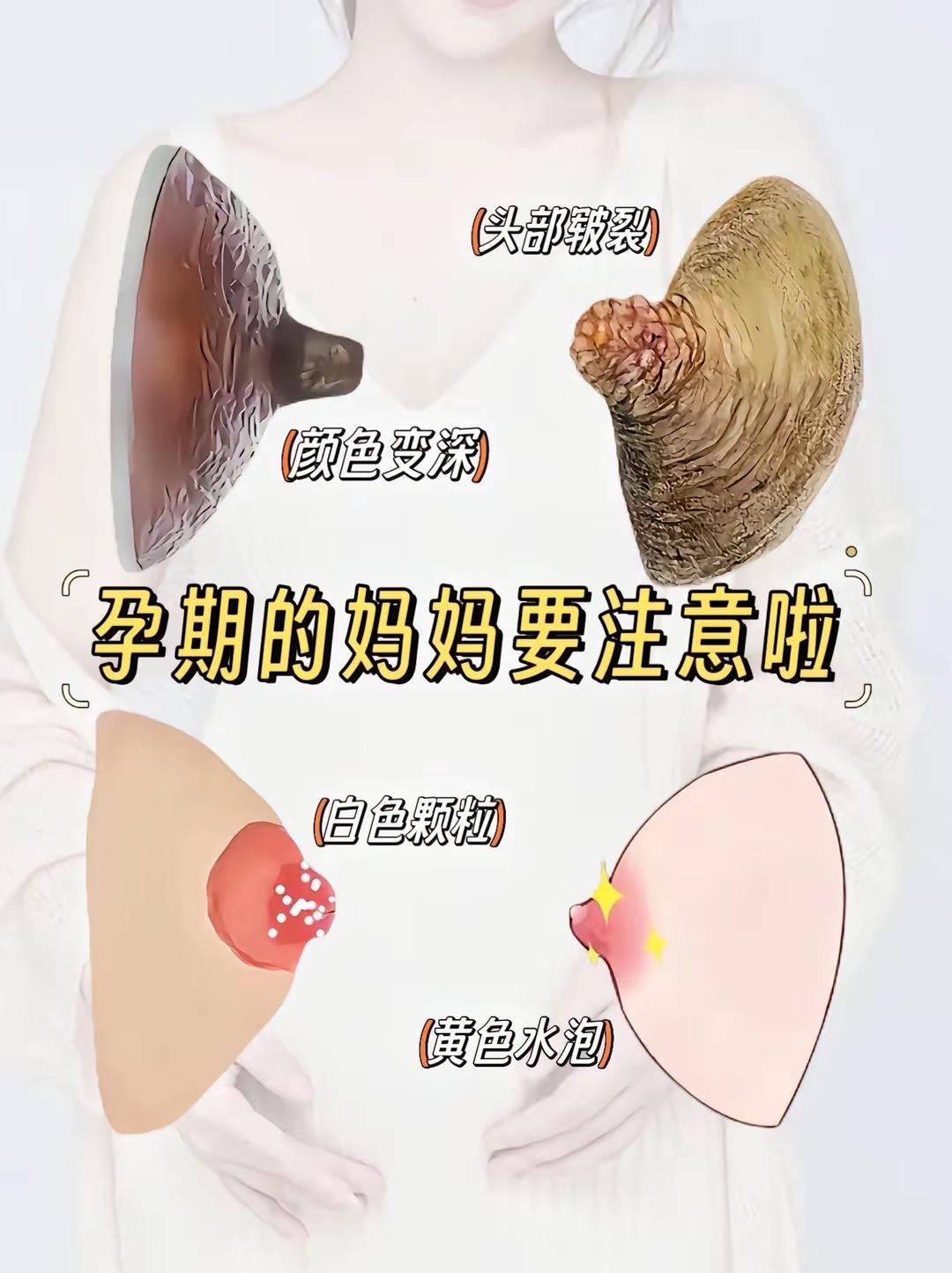 孕期的宝藏好物~羊脂膏推荐 姐妹们,孕期就要注意我们的小房子护理了,羊脂膏是很好的选择,它可以滋润皮肤,起到软化作用,我整个孕期都在用#袋鼠妈妈 家的,它成分很安全,宝宝入口也不怕,还一膏多用,基本不会闲置,孕妈们可以放心入手哦~真的很值得呢#哺乳期#羊脂膏推荐 #孕妇专用 #图文掘金计划