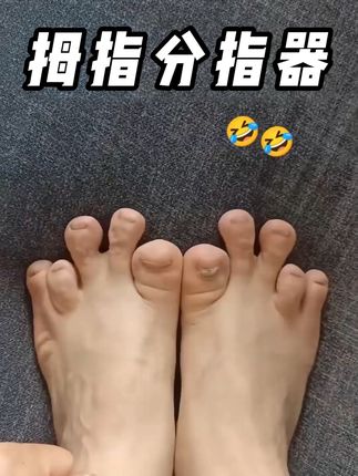 腿不直的要趁早,有这么好用的分趾器脚趾再也不用愁了! #分趾器#拇外翻#脚趾#O型腿#腿型