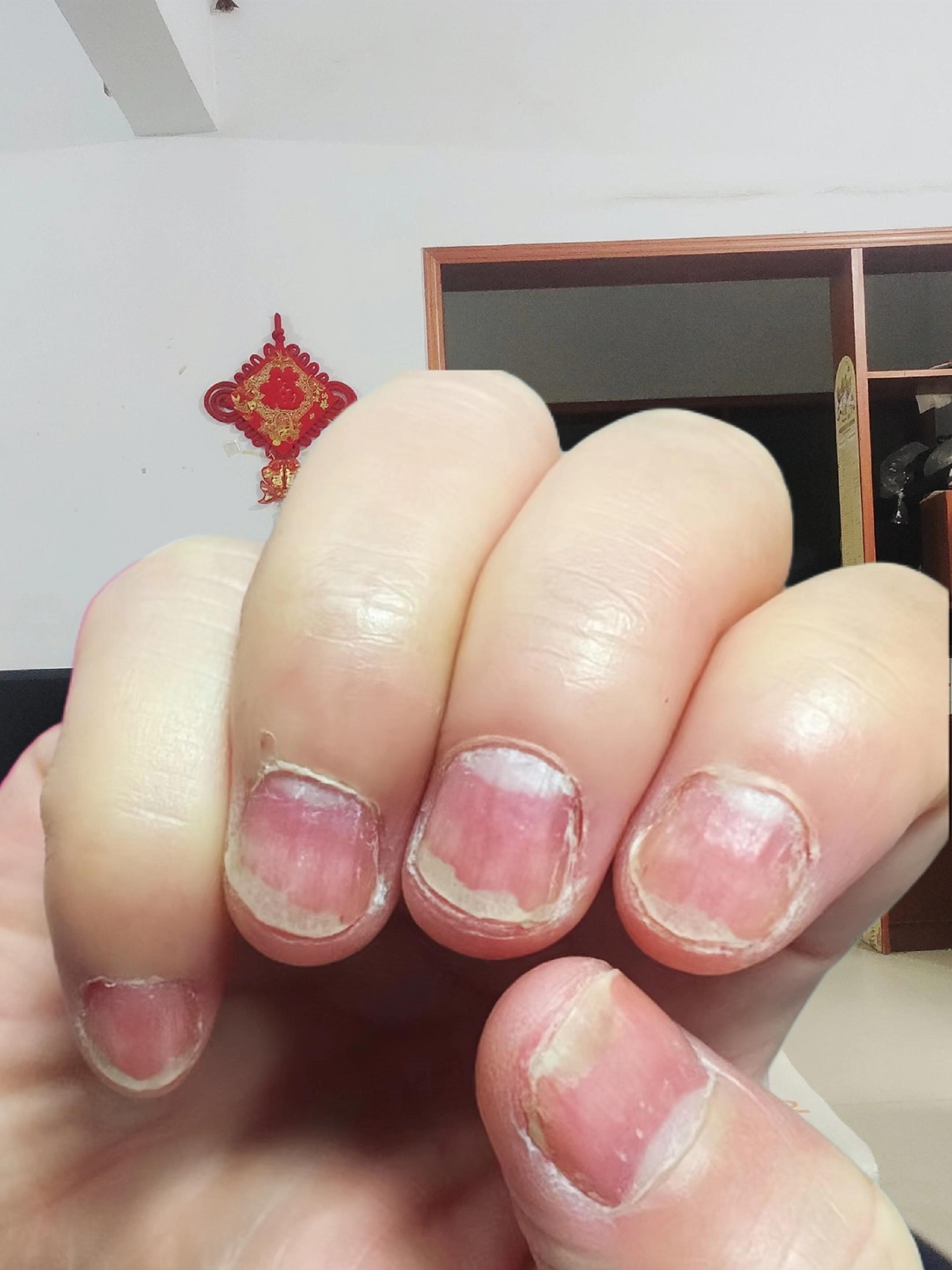 #指甲 #脚趾甲 #日常分享 #指甲盖 #强烈推荐