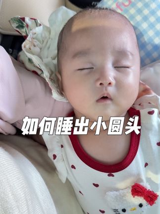 关于我是如何把妙妙从舟状头睡成小圆头 #定型枕#sohiwoo定型枕 #睡圆头攻略 #宝宝偏头怎么纠正 #母婴好物