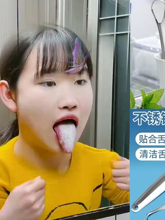 胖猫刮舌器舌苔清理神器不锈钢舌刮器舌头清洁刮板舌面肉口腔工具#厂家直发品质保证 #爆款热卖中