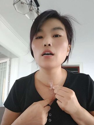 #甲状腺癌#甲状腺癌患者的日常