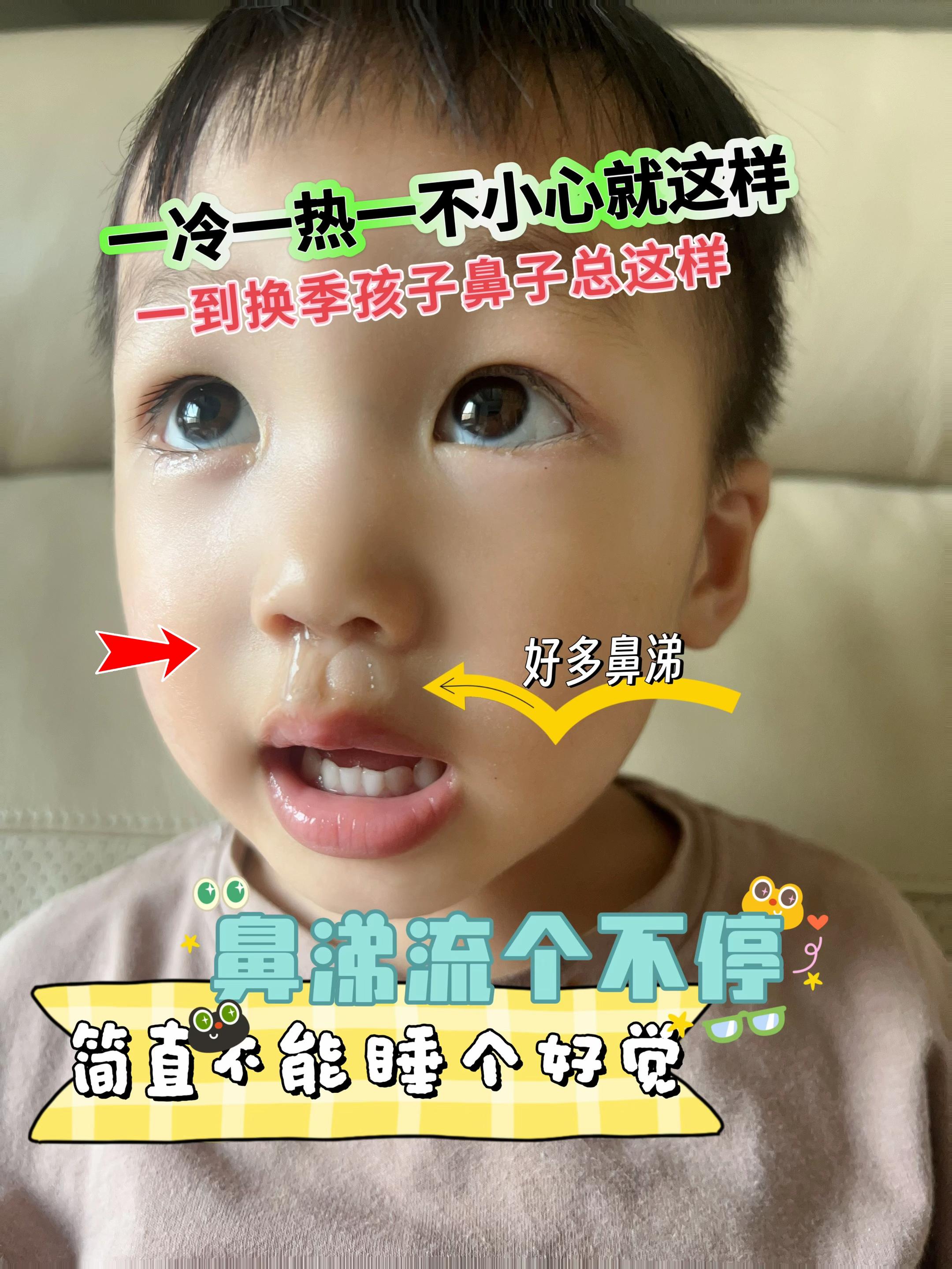 一到换季孩子就的鼻子就有这样的小状况了!当妈的真的很焦虑!所以姐妹给我推荐了这个贴贴,当了妈妈后只要对孩子好的,都愿意去给孩子,这个不用进嘴就很好用,当然要给宝宝试一试!#换季孩子流鼻涕#新手妈妈 #育儿 #宝宝流鼻涕怎么办 #流鼻涕鼻塞了