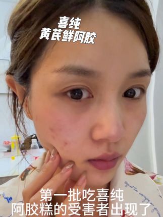 养好自己真的不难,每天几片阿胶糕#女生必备#好好爱自己#喜纯黄芪鲜阿胶#精致女人必备