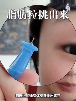 脂肪粒挑出来的太爽了#强烈推荐 #我捡到宝了 #解压 #脂肪粒没了 #亲测