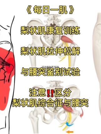 梨状肌(3)——注意‼️区分梨状肌综合征与腰突!今天一个视频带你学会梨状肌康复训练;梨状肌拉伸松解;以及与腰突鉴别试验。 #青年创作者计划 #运动康复 #运动解剖 #医学科普 #运动康复训练