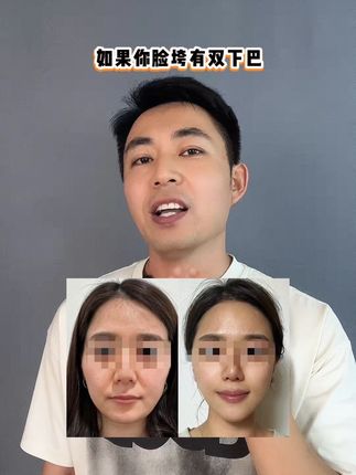 脸垮有双下巴,大肚腩一直下不去的姐妹有福了,每天5分钟,一个月后你会感谢现在自律的自己!#瘦下来做最美的自己 #大肚腩变小蛮腰 #逆袭 #拯救垮脸 #腹式呼吸