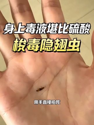 隐翅虫身上的毒液堪比硫酸,家里出现隐翅虫不建议用手拍,容易引发皮炎,导致皮肤腐蚀溃烂!必要时可以使用专业的杀虫剂进行灭防!#毒隐翅虫 #隐翅虫杀虫剂 #梭毒隐翅虫 #隐翅虫的毒液堪比硫酸 #隐翅虫怎么预防消杀