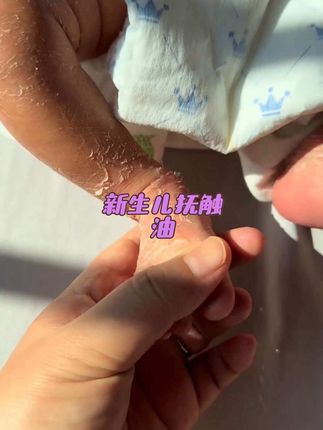 女儿出生以后浑身都在"蜕皮",还好 提前准备了#抚触油 涂几次就光滑了,平时给宝宝做抚触也要用,植物的很放心!#母婴好物 #宝妈推荐 @抖音小助手 #宝宝抚触