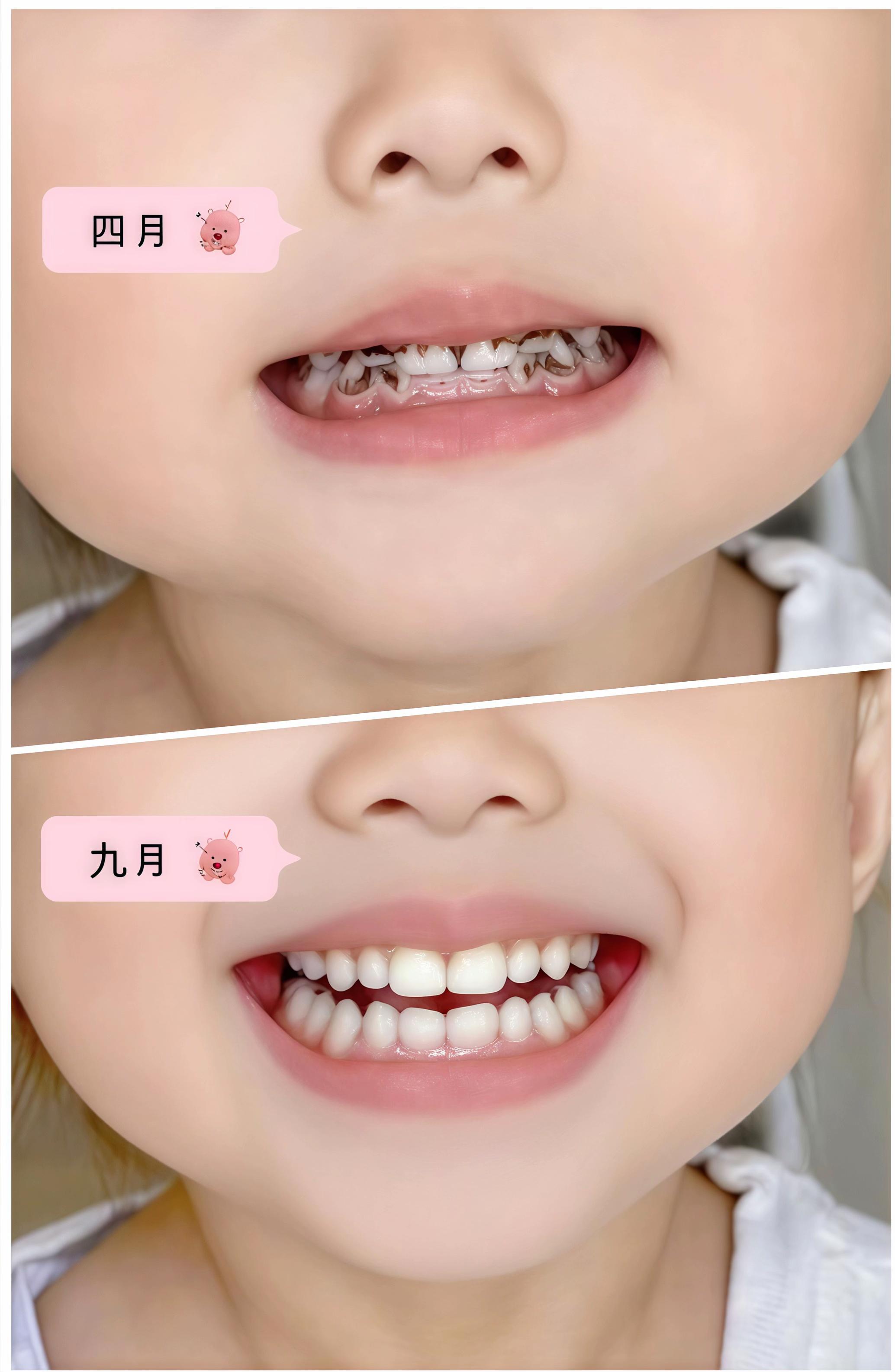 #舒客宝贝#儿童牙膏#爱牙护牙 #抗糖防蛀 #保护牙齿