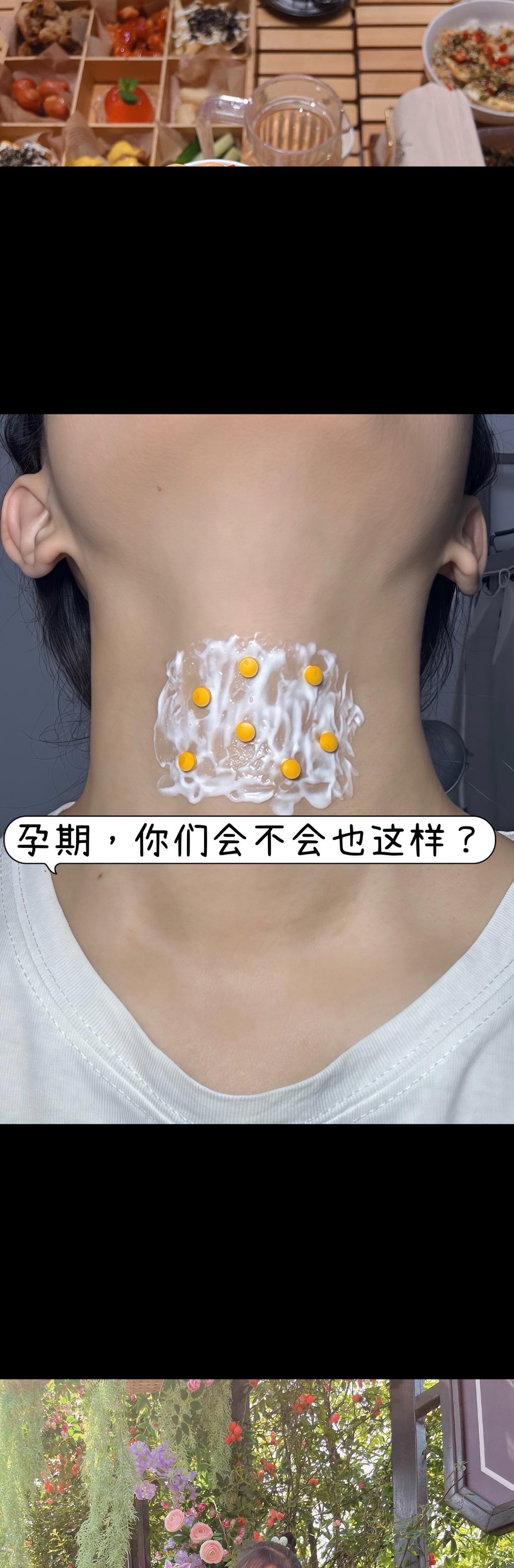 孕期颈纹看过来~袋鼠妈妈颈霜太懂我了!温和滋润,孕妈放心用~大容量超耐用,一抹一涂超方便,肤感清爽超舒服,颈纹拜拜就靠它!#孕期护肤#淡化颈纹 #袋鼠妈妈 #颈霜#去颈纹