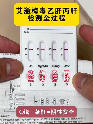 谈恋爱发生关系前 要测一下这个 很重要 #恋爱 #奔现 #异地恋 #感染四项
