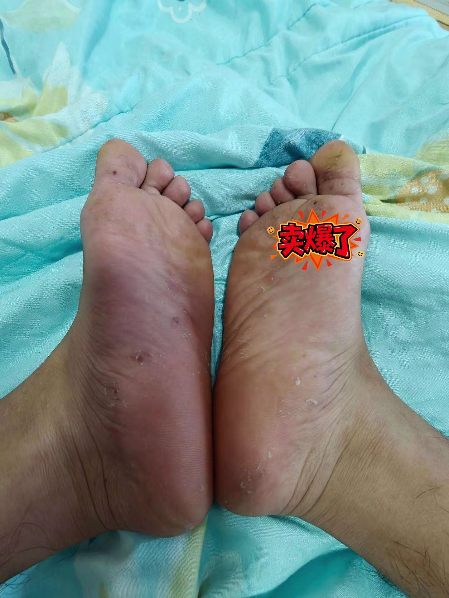 #脚 #我的脚脚 #脚丫子