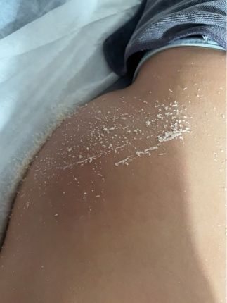 #老刀修面刮脸 #老刀修背除螨 #刮脸修面采耳 #洗眼护眼养眼 @抖音小助手 @抖音创作者大会 @抖音来客官方助推官 @