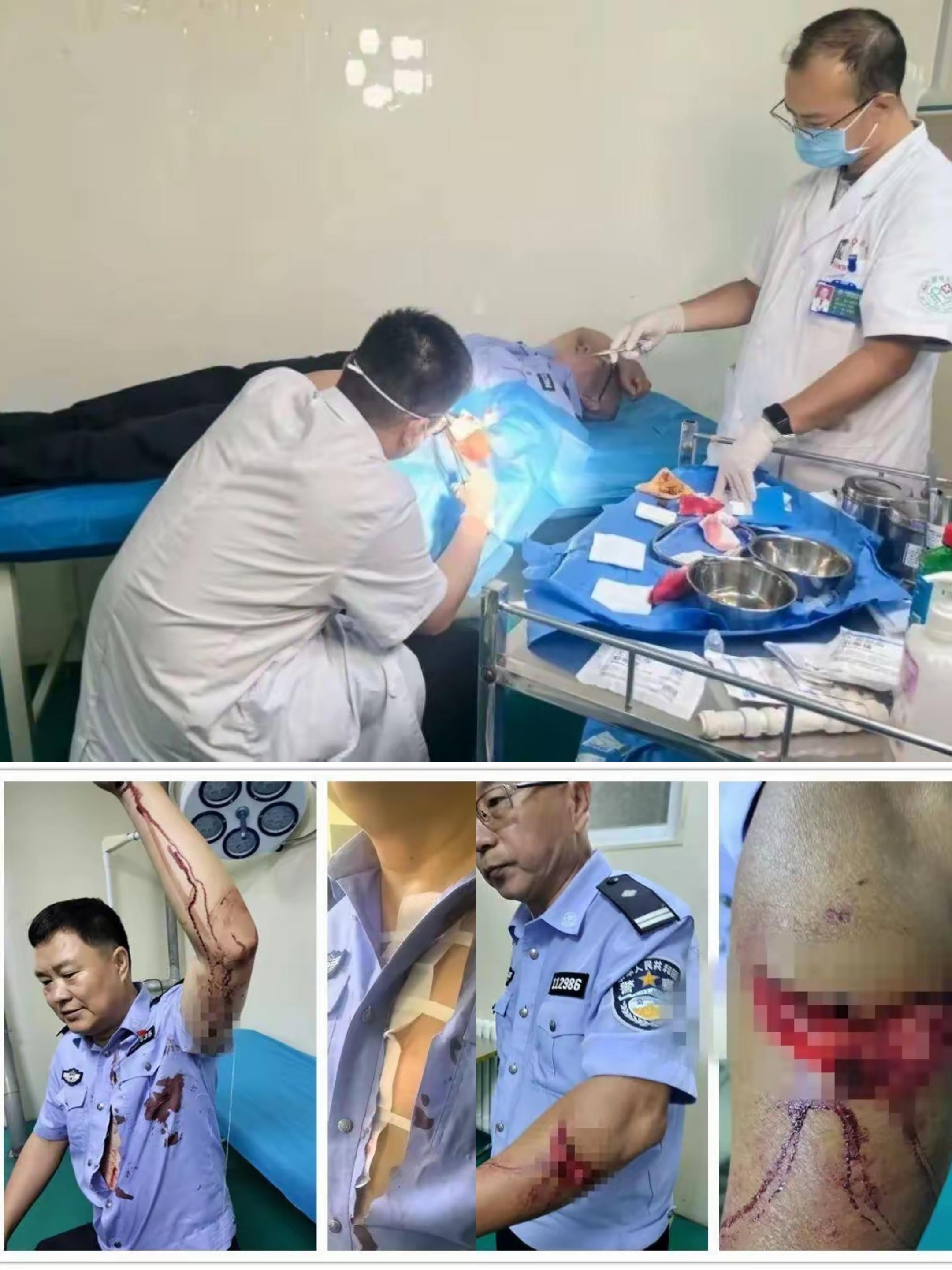 内蒙古一男子在小区内持刀行凶!两名警察被刺伤,送医后对伤口进行了缝合,其中一人左侧前臂缝合30余针。当危险突如其来他们英勇无畏、选择直面刀锋!当群众需要守护他们舍生忘死、用血肉之躯筑起防线!#致敬人民警察