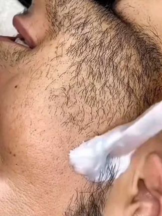 #简斯琪脱毛蜜蜡 #蜜蜡拔胡子 #蜜蜡脱毛男女通用