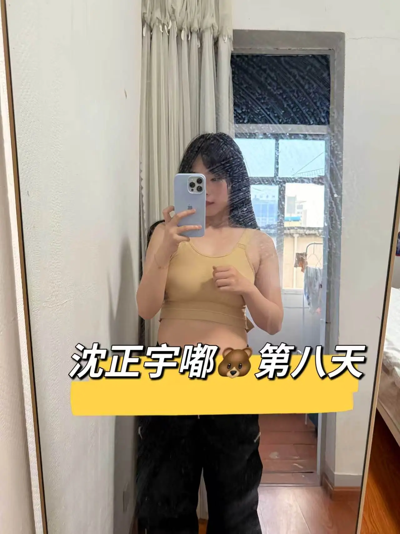 隆🐻Day8 异物感减弱|逐步适应 术后第八天,胸部僵硬感 - 抖音