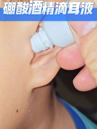 视频同款商品#硼酸酒精抑菌滴耳液#