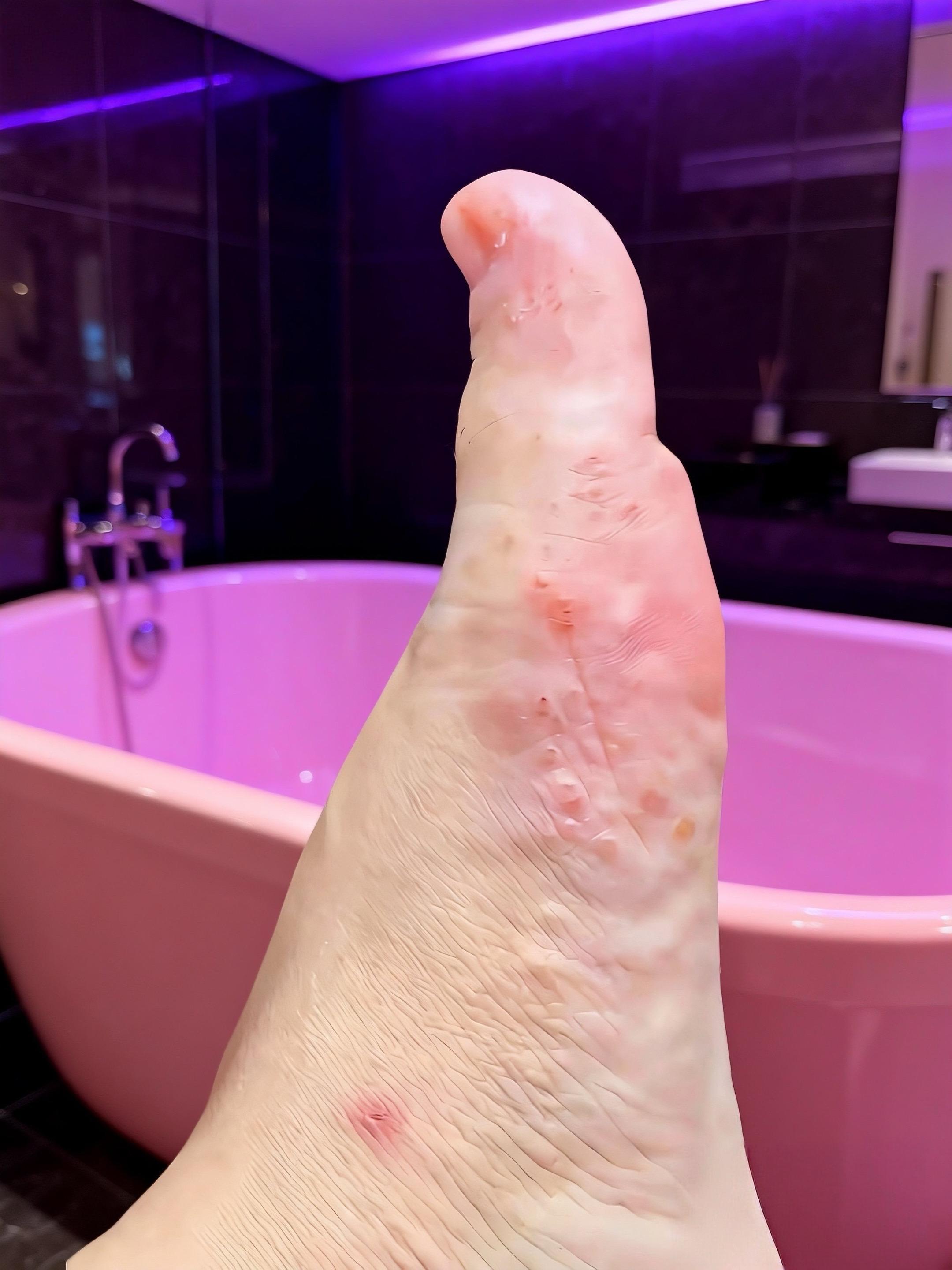 再也不用忍受痛苦了,老牌子用着放心,好开心~#万万没想到#可爱的小脚丫 #足部护理#无处安放的小jio