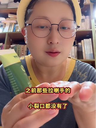 手足干裂脱皮|白护康手足修护膏!#手足裂口 #手足综合症 #手干燥粗糙 #脚干裂 #自用好物分享